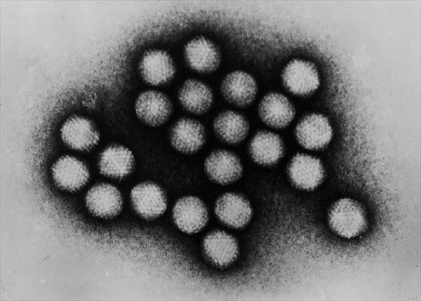 Adenovirus_transmission_electron_micrograph_B82-0142_lores_R