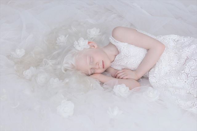 albino_05_640