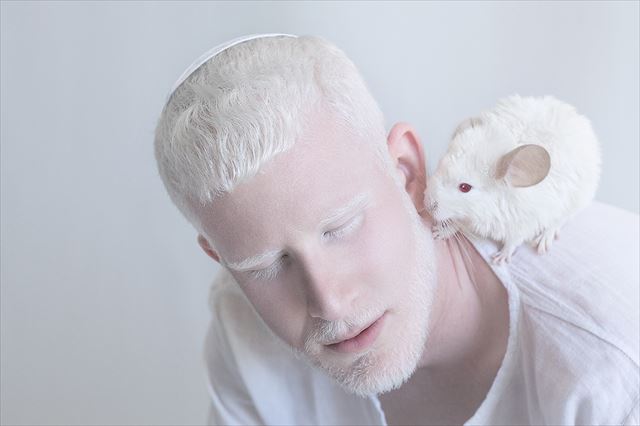 albino_06_640