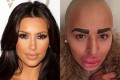 「キム・カーダシアンになりたい！」と男性が1,800万円かけて整形した結果
