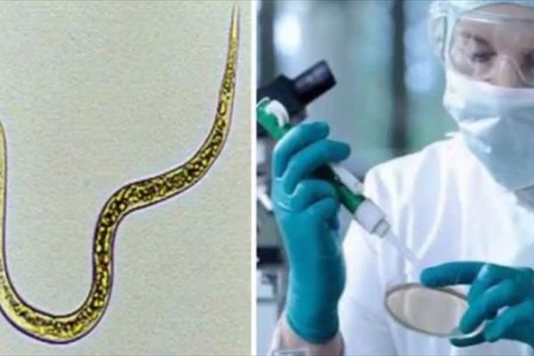 尿1滴からガンを95%以上の確率で判別できる!九州大が画期的技術を開発