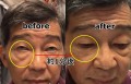塗るだけで目元のシワが消える?魔法のクリームを試したビフォーアフター映像