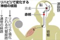 「脳出血よるまひ」を“リハビリで改善するメカニズム”が明らかとなり話題に!