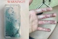 化学火傷?“液体入りのスマホケース”の液体漏れが危険だと話題に!