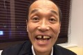 東国原英夫氏の歯が抜けた→「乳歯ですか?」「どげんかせんといかん」等ツッコミ止まず
