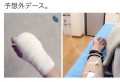 意外と知らない!?猫に咬まれて「パスツレラ症」になってしまった人の体験談が怖い!