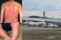 7月~8月の関西空港利用者を中心に“はしか”の患者が急増! 厚労省が注意喚起