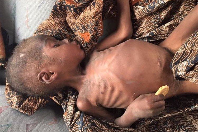 なぜこんな目に…両親に「魔女」だとされて捨てられた2歳の男の子、そして1年後の姿