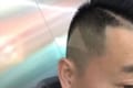 美容院に行ったら「三角ハゲ」にされちゃった...！その理由に思わず爆笑