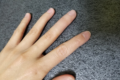 日本の技術は素晴らしい!指先を損傷しピアノを諦めるも、義肢によって再び演奏できるように