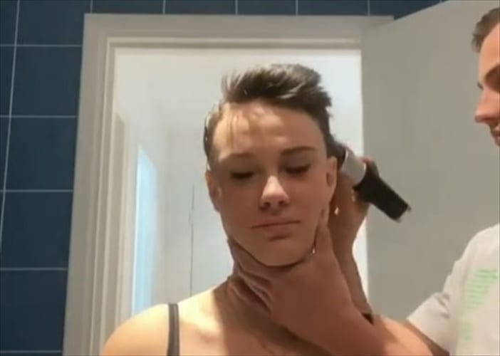 脱毛症で苦悩する女性、剃髪を手伝った恋人が最後に見せた行動に思わず涙