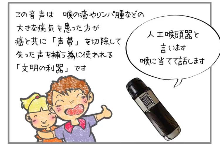 みんなに知ってほしい！「人工喉頭器」を使った声をコマごと録音した動画に反響