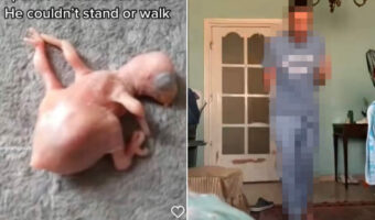 【世界で話題となった動画】先天性欠損症で産まれたインコのヒナ。献身的に治療した男性が、ヒナが歩いた喜びを爆発させる動画に感動！