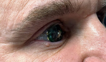 SF映画の世界はすぐそこ？ARコンタクトレンズが凄い！