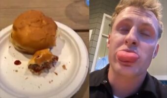 ハンバーガーを食べていたら口内で激痛が･･･口を開けてみると目を疑う事態が起きていた！